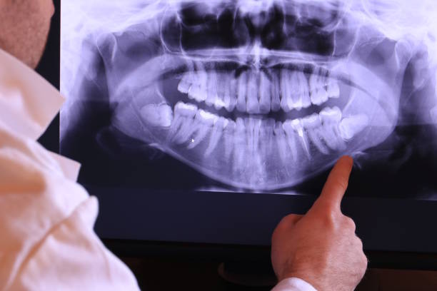 Best Emergency Dentist for Lost Fillings or Crowns in Oolitic, IN