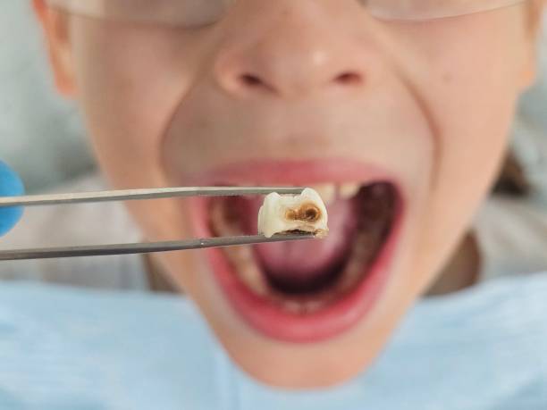 Best Pediatric Emergency Dentist in Oolitic, IN