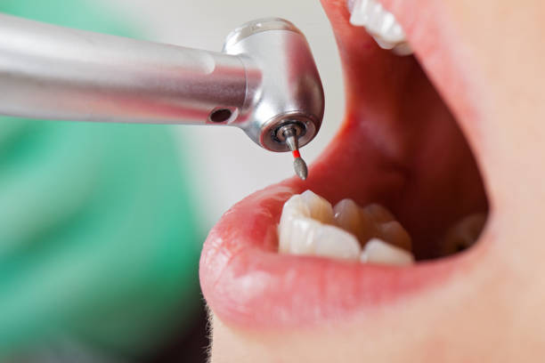 Best Emergency Dentist for Special Needs Patients in Oolitic, IN